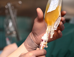 WHAT IS CONVALESCENT PLASMA? Hand holding a bag of plasma at hamilton medical center
