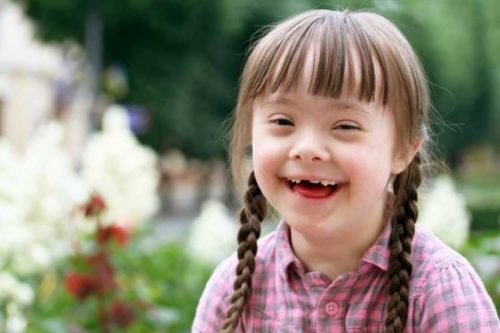 Young girl with down syndrome